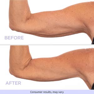 Image credits: gopure