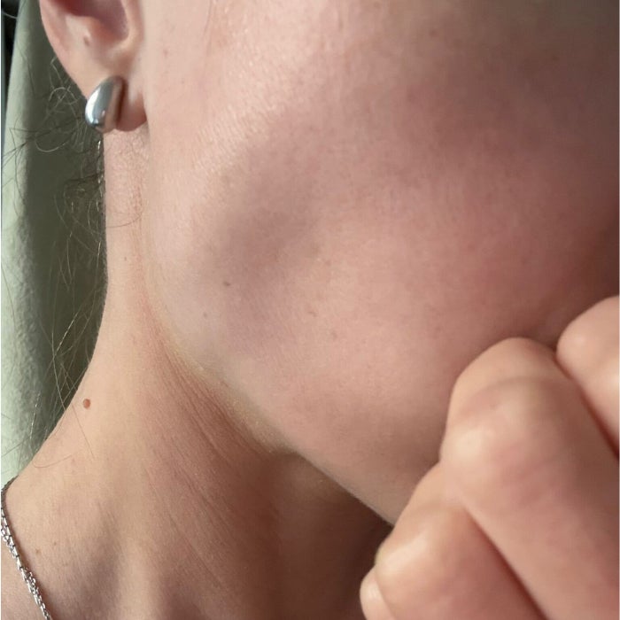Tester Anastasia Bilzhause's cheek after applying Beauty of Joseon Day Dew Sunscreen SPF 50