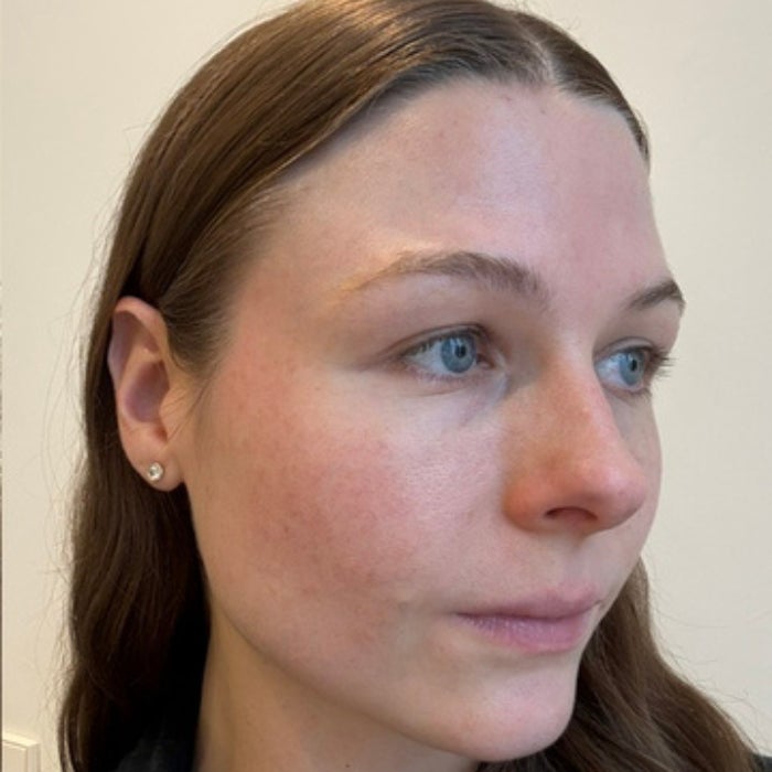 Tester Allison Wall before applying the NEOGEN Day Light Protection Airy Sunscreen SPF 50+ to her face.