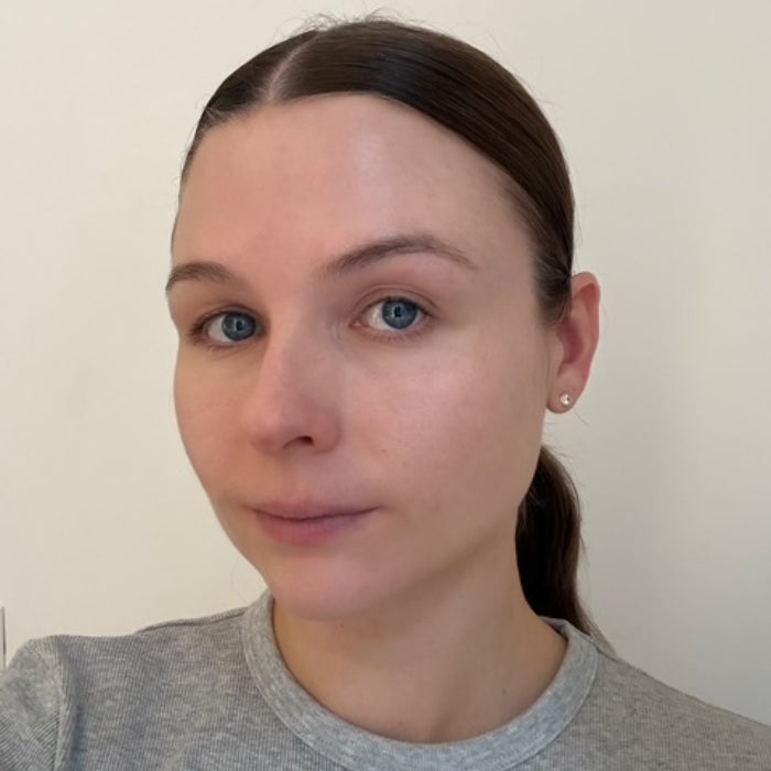 Allison Wall's face before applying tarte Maracuja Juicy Lip Plump against a white background