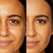 Concealers For Dark Circles