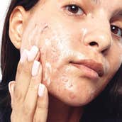 Face Washes for Acne